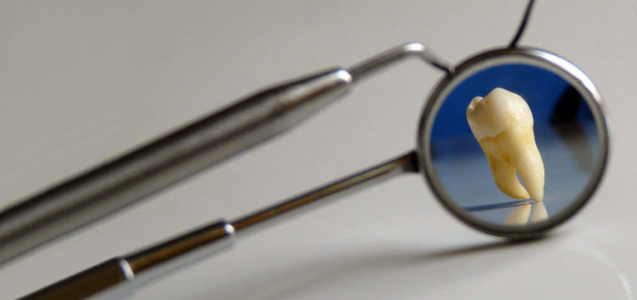 The climate change choice has an analogy in dentistry... Image: Partha S Sarhana, Creative Commons licence